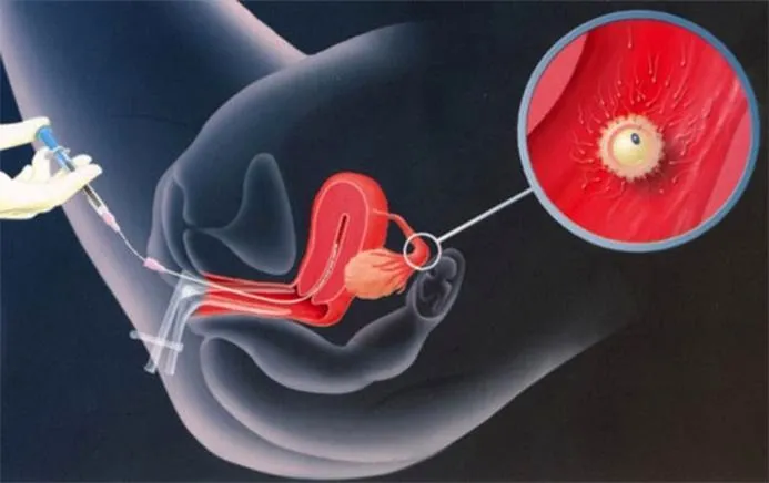 Czy inseminacja budzi kontrowersje wśród duchownych?